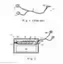 Fig. 02 - Earphone spiro-device