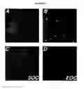Fig. 02 - Smooth muscle progenitor cells