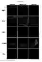 Fig. 03 - Smooth muscle progenitor cells