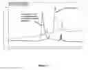 Fig. 12 - Production of multivalent virus like particles