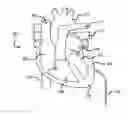 Fig. 01 - Methods and Systems for Treating Injured Cardiac Tissue