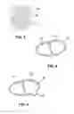 Fig. 03 - Methods and Systems for Treating Injured Cardiac Tissue