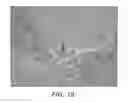Fig. 12 - Methods and Systems for Treating Injured Cardiac Tissue