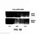 Fig. 06 - Medical device with coating that promotes endothelial cell adherence and differentiation