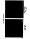 Fig. 11 - Medical device with coating that promotes endothelial cell adherence and differentiation