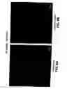 Fig. 12 - Medical device with coating that promotes endothelial cell adherence and differentiation