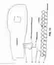 Fig. 16 - Medical device with coating that promotes endothelial cell adherence and differentiation
