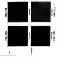 Fig. 17 - Medical device with coating that promotes endothelial cell adherence and differentiation