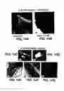 Fig. 19 - Medical device with coating that promotes endothelial cell adherence and differentiation