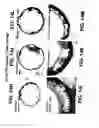 Fig. 20 - Medical device with coating that promotes endothelial cell adherence and differentiation