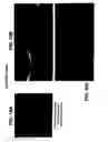 Fig. 21 - Medical device with coating that promotes endothelial cell adherence and differentiation