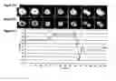 Fig. 02 - Methods and device for adhesive control of internal cell organisation