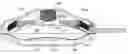 Fig. 01 - Miniature pump for drug delivery