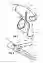 Fig. 06 - Vessel sealer and divider for use with small trocars and cannulas