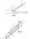 Fig. 07 - Vessel sealer and divider for use with small trocars and cannulas