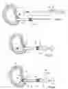 Fig. 09 - System and devices for the repair of a vertebral disc defect