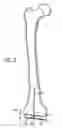 Fig. 03 - Method and system for determining resection guidelines for joint replacement surgical procedures