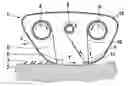 Fig. 02 - Epilator