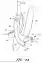 Fig. 08 - Suturing device and method