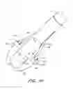Fig. 45 - Suturing device and method