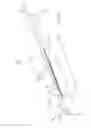 Fig. 03 - DELIVERY CATHETER