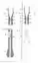 Fig. 23 - DELIVERY CATHETER