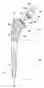 Fig. 01 - Intrinsic stability in a total hip stem