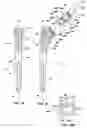Fig. 10 - Intrinsic stability in a total hip stem