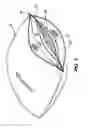 Fig. 02 - Pillow and method of manufacturing a pillow