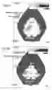 Fig. 08 - Method for correcting a static posture of a head portion and a static posture correcting apparatus