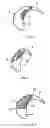 Fig. 02 - Behind the ear hearing device housing with self-adhering properties