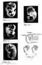 Fig. 02 - Method of treating dopaminergic and GABA-nergic disorders