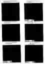 Fig. 06 - Non-toxic mutants of pathogenic gram-negative bacteria