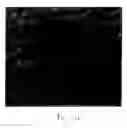 Fig. 06 - Isolation of inner cell mass for the establishment of human embryonic stem cell (hESC) lines