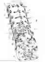 Fig. 03 - Threshing tine for a combine rotor
