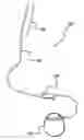 Fig. 01 - Lead anchor for implantable stimulation devices and methods of manufacture and use