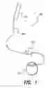 Fig. 02 - Lead anchor for implantable stimulation devices and methods of manufacture and use