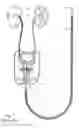 Fig. 02 - Coaxial dilatation method for stent implantation