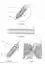 Fig. 06 - Coaxial dilatation method for stent implantation