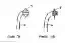 Fig. 09 - Devices and methods for treatment of vascular aneurysms