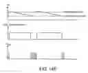 Fig. 20 - Razors