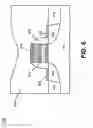 Fig. 12 - Junction leakage suppression in memory devices