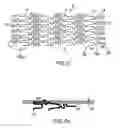 Fig. 05 - System of loading beneficial agent to a prosthesis by fluid-jet