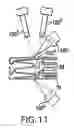 Fig. 10 - System of loading beneficial agent to a prosthesis by fluid-jet