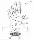 Fig. 01 - Elastomeric gloves and methods of making
