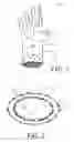 Fig. 02 - Elastomeric gloves and methods of making