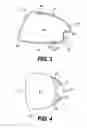 Fig. 03 - Golf club head