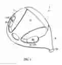 Fig. 04 - Golf club head