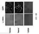 Fig. 05 - Composition and Method for Treatment and Prevention of Restenosis