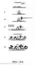 Fig. 11 - Composition and Method for Treatment and Prevention of Restenosis